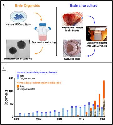 Modeling the Human Brain With ex vivo Slices and in vitro Organoids for Translational Neuroscience